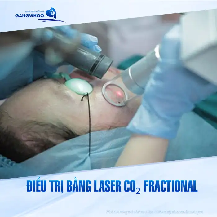 9+ Cách điều trị mụn thịt trên mặt an toàn, hiệu quả nhanh chóng