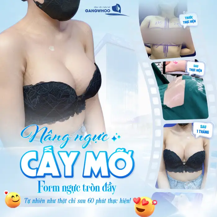 Bật mí cách nâng ngực chảy xệ hiệu quả, an toàn tại nhà