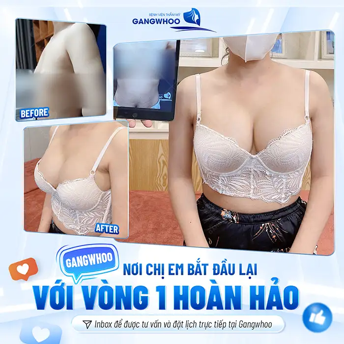 Tham khảo 5 cách nâng ngực khi mặc Bikini hiệu quả