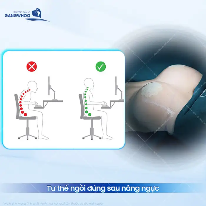 Cách tự ngồi dậy sau khi nâng ngực tránh ảnh hưởng đến túi ngực