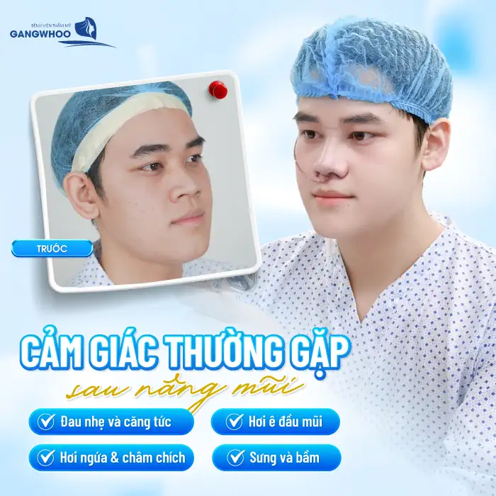 Cảm nhận sau nâng mũi ngày đầu tiên ra sao? Có khó chịu không?