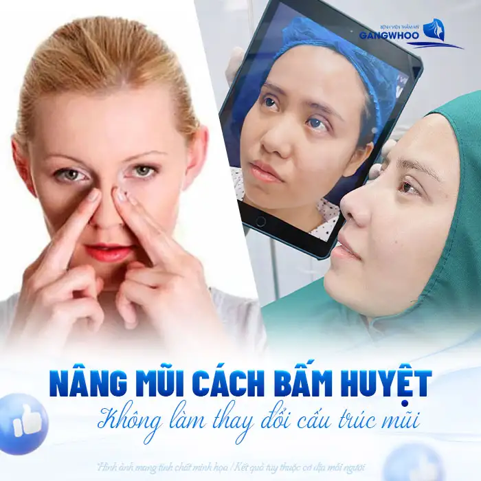 Nâng mũi bằng cách bấm huyệt có hiệu quả không? Có nên thực hiện