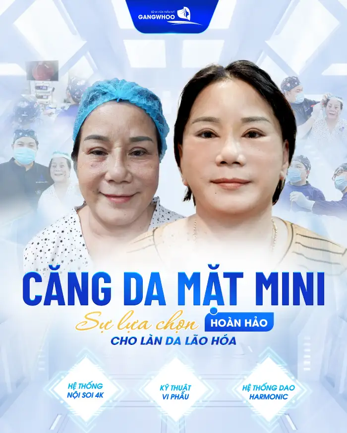 Căng da mặt mini là gì? Ưu. nhược điểm của phương pháp này là gì?