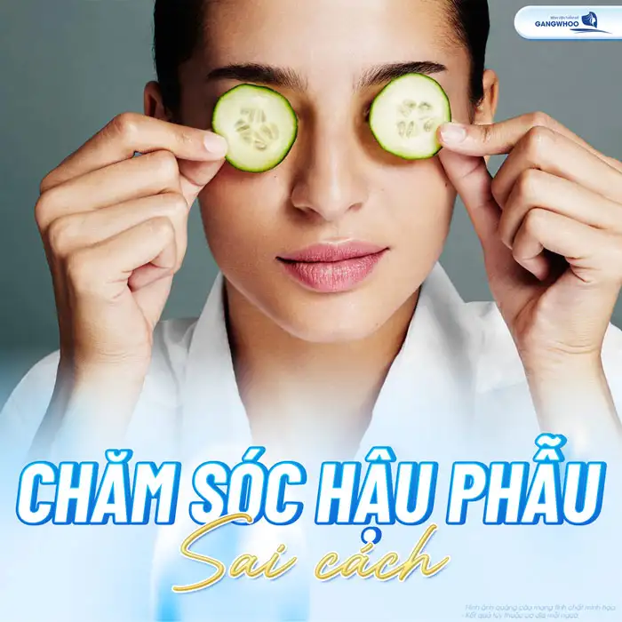 Cắt mí bao lâu hết sưng? Cách giảm sưng hiệu quả là gì?