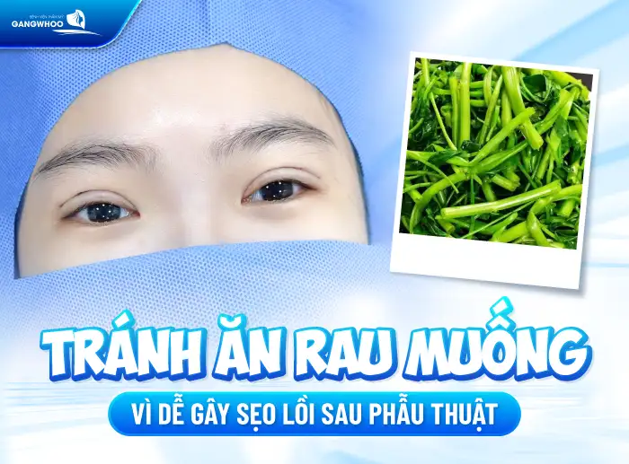 Cắt mí mắt kiêng ăn gì? Cách lựa chọn thực phẩm giúp nhanh lành sau cắt mí