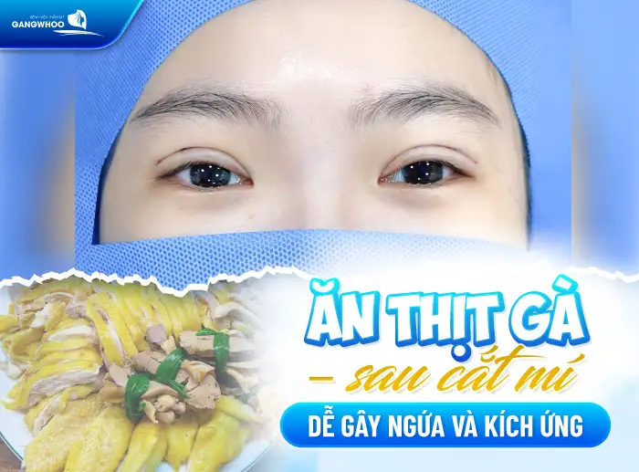 Cắt mí mắt kiêng ăn gì? Cách lựa chọn thực phẩm giúp nhanh lành sau cắt mí