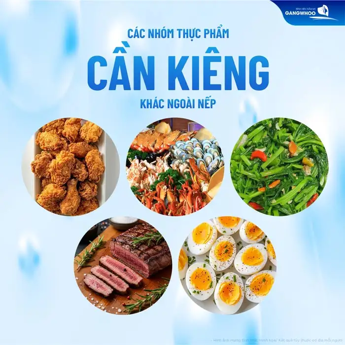 Cắt mí kiêng đồ nếp bao lâu? Vì sao cần phải kiêng ăn đồ nếp?