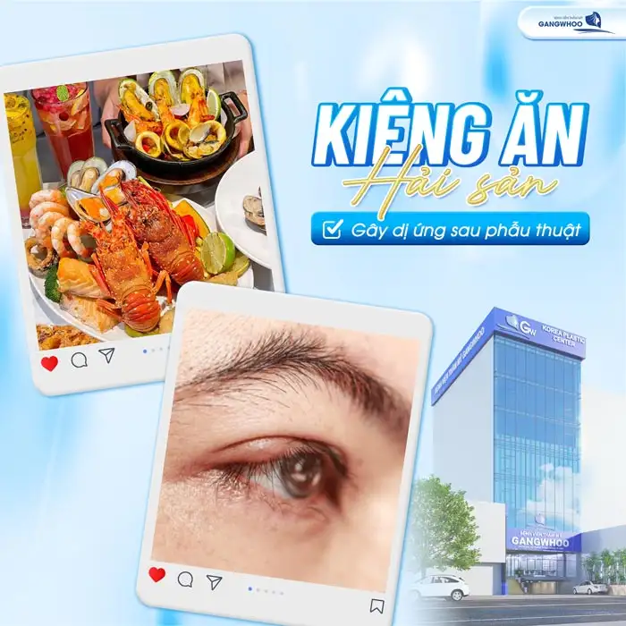 Cắt mí kiêng hải sản bao lâu? Vì sao cần phải kiêng hải sản?