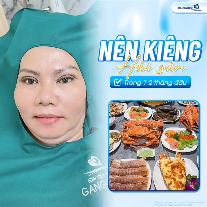 Cắt mí kiêng hải sản bao lâu? Vì sao cần phải kiêng hải sản?