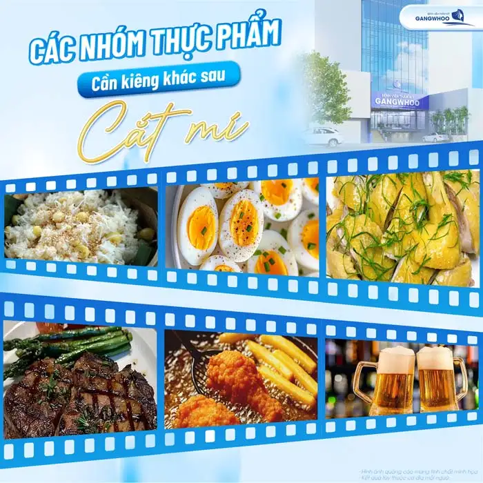 Cắt mí kiêng hải sản bao lâu? Vì sao cần phải kiêng hải sản?