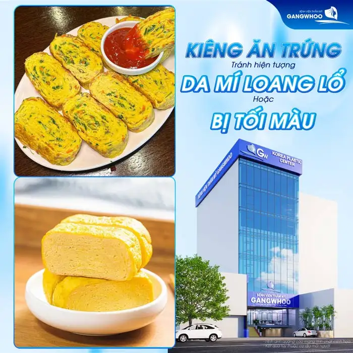Cắt mí kiêng trứng bao lâu? Khi nào thì được ăn trứng?