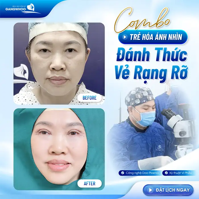 Cắt mí mắt có để lại sẹo không? Yếu tố gây ra sẹo là gì?