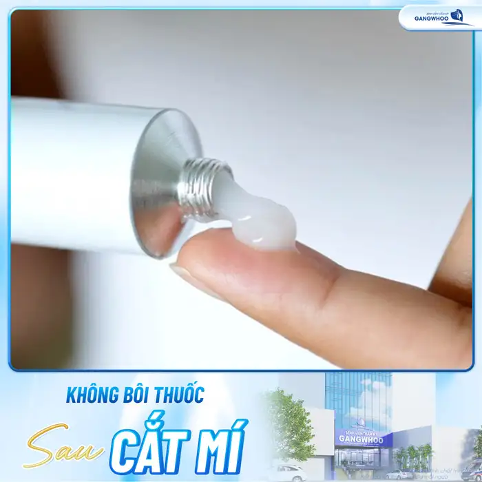 Cắt mí mắt có để lại sẹo không? Yếu tố gây ra sẹo là gì?