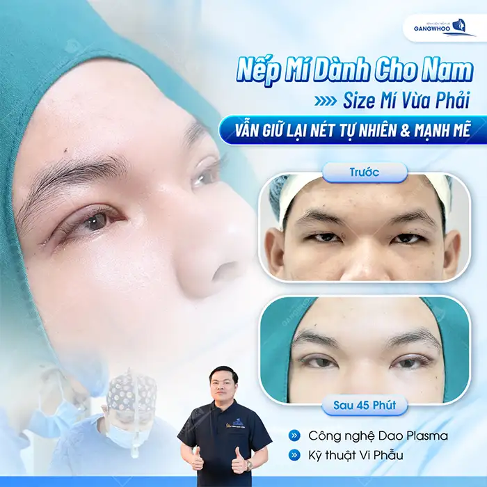 Cắt mí mắt có được vĩnh viễn không? Cách duy trì mí mắt đẹp lâu dài