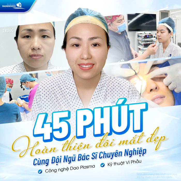 Cắt mí Plasma là gì? Có nên lựa chọn phương pháp cắt mí Plasma?