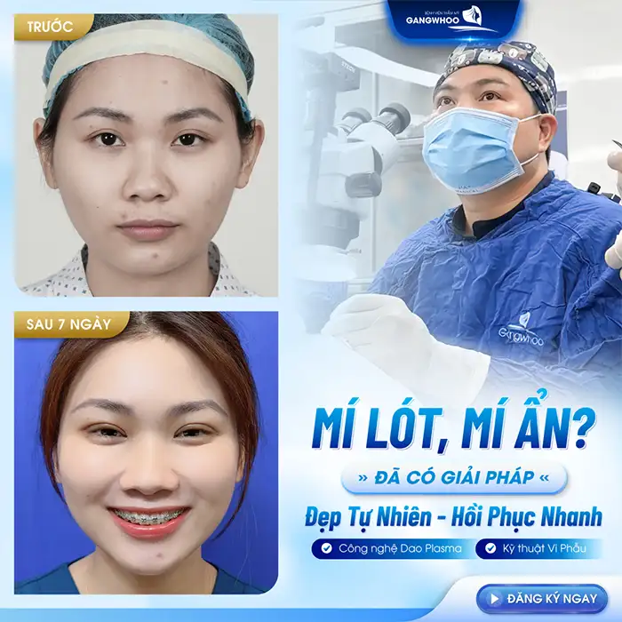 Cắt mí sau 6 tháng thì vết thương đã lành và ổn định chưa?