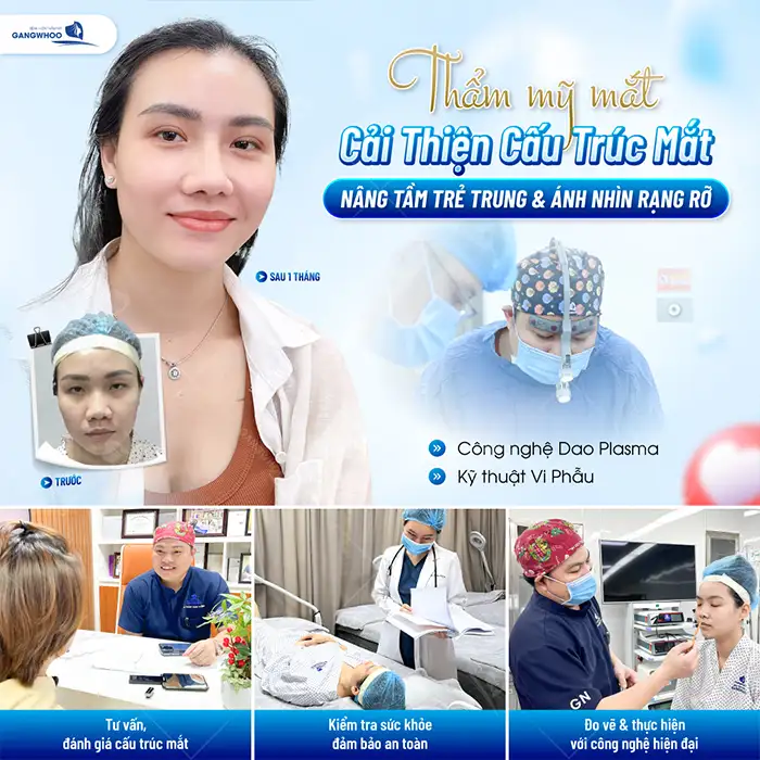 Cắt mí sâu tây là gì? Có nên lựa chọn cắt mí sâu tây không?