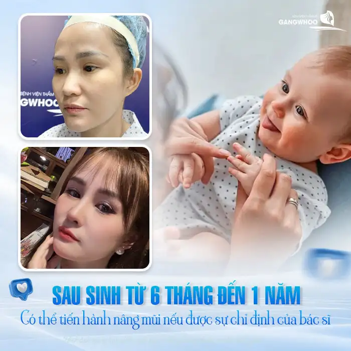 Có bầu đi nâng mũi được không? Có ảnh hưởng đến thai nhi không?