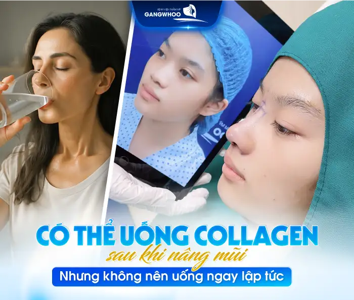 Có được uống Collagen sau khi nâng mũi? Lưu ý khi bổ sung Collagen