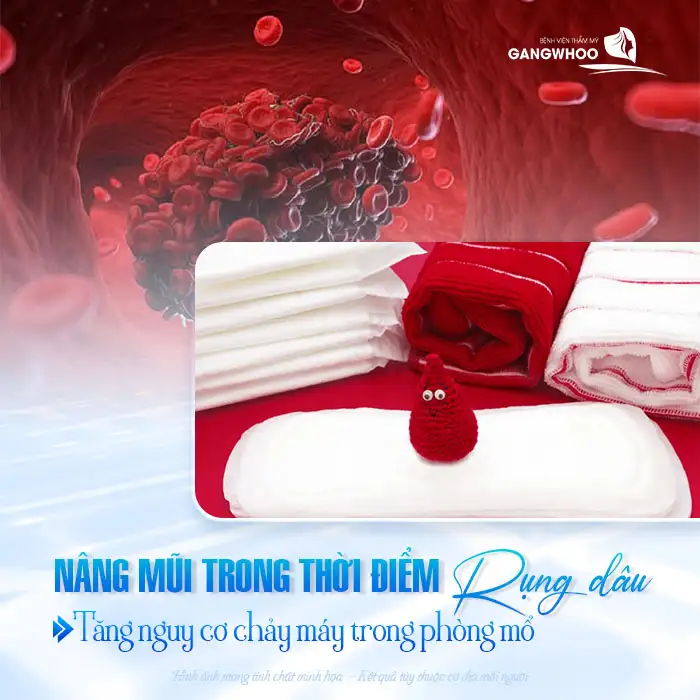 Có kinh có nâng mũi được không? Cần phải tránh không?