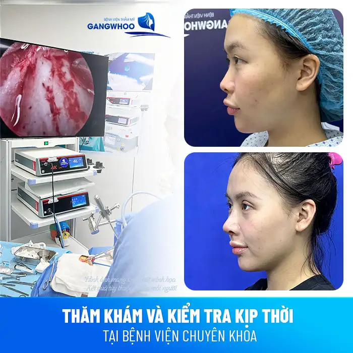 Dấu hiệu nhiễm trùng sau khi nâng mũi và cách xử lý hiệu quả