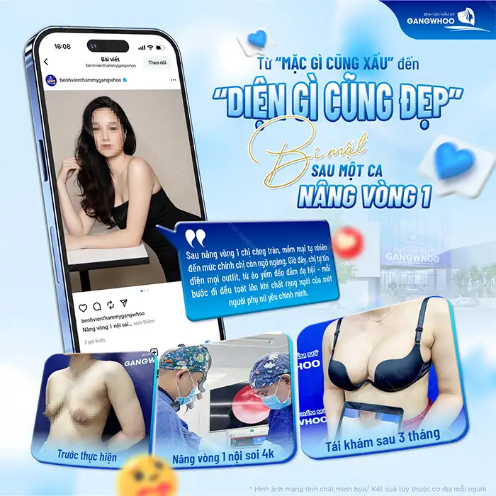 Có nên nâng ngực size 400 không? Size 400 có to quá không?