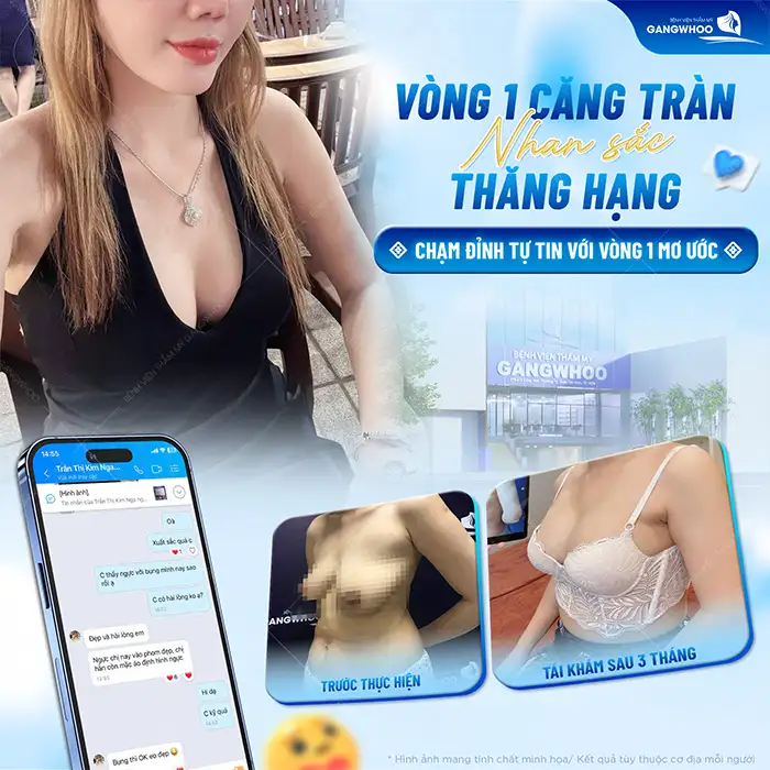 Giá nâng ngực Nano Chip Ergonomix bao nhiêu? Cập nhật giá mới nhất 2025