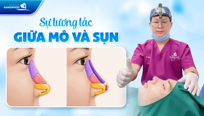 Bị giật mũi sau khi nâng có phải biến chứng không? Nguyên nhân là gì?