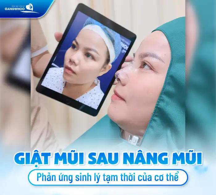 Bị giật mũi sau khi nâng có phải biến chứng không? Nguyên nhân là gì?