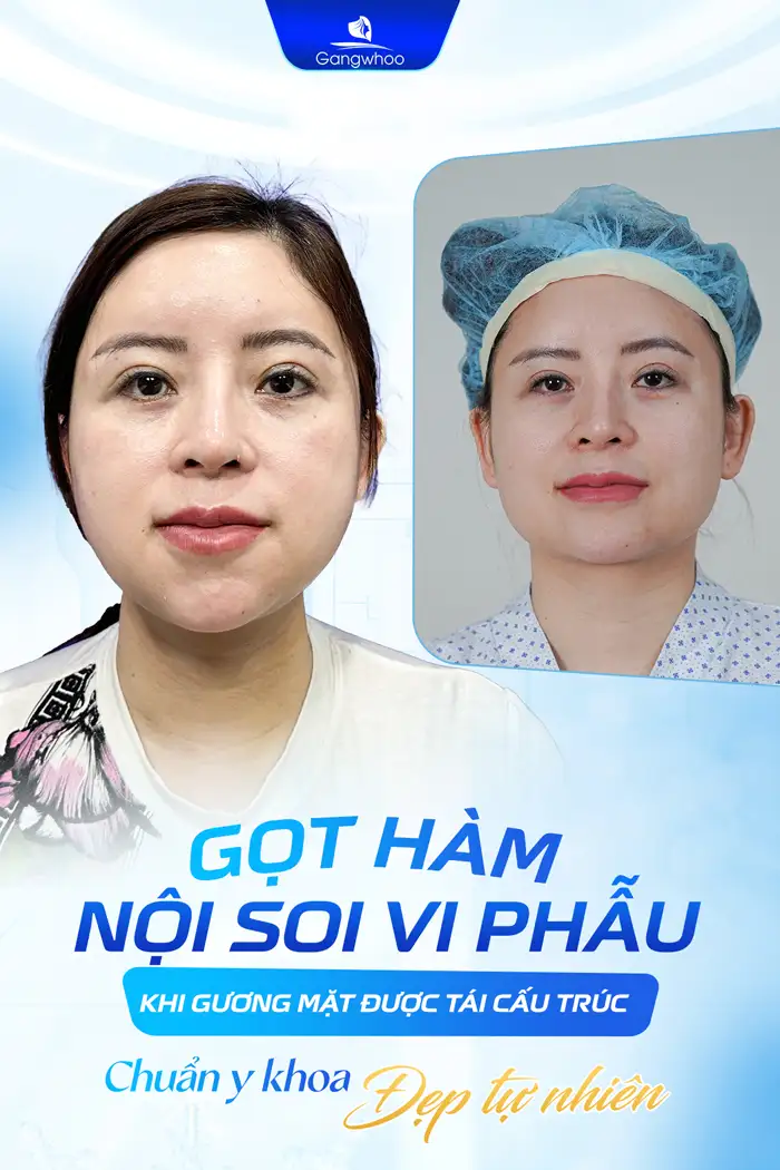 Gọt hàm có đau không? Có gây ra biến chứng gì không?