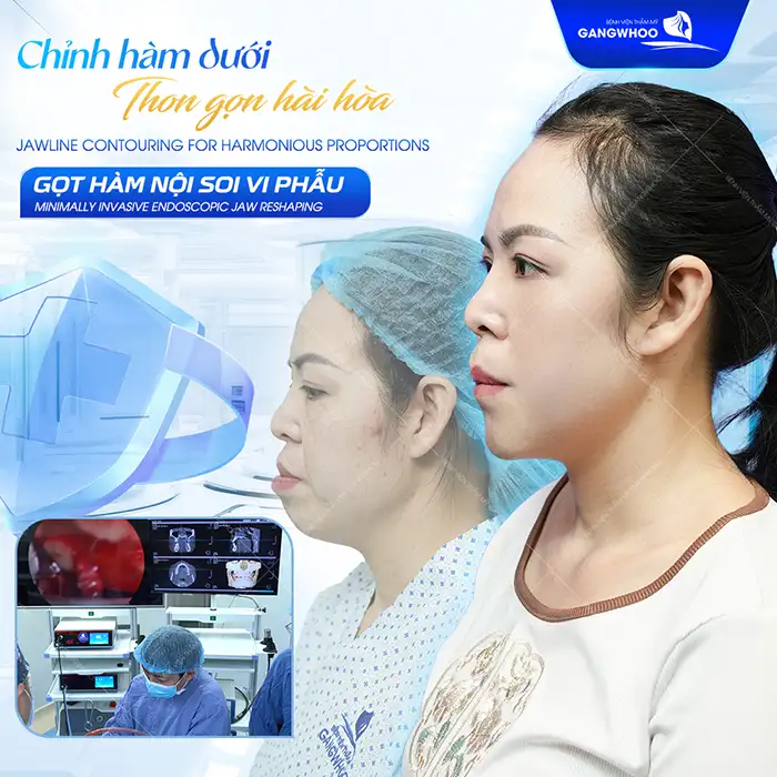 Gọt hàm có để lại di chứng về sau không? Cần lưu ý những gì?