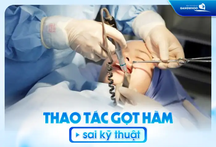 Gọt hàm có để lại di chứng về sau không? Cần lưu ý những gì?