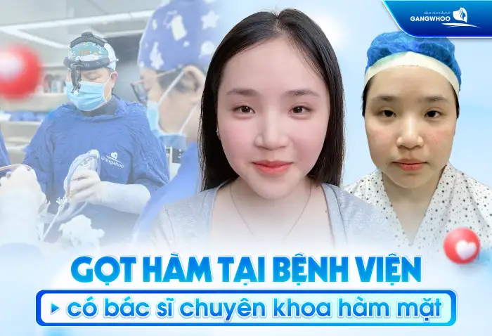 Gọt hàm có để lại di chứng về sau không? Cần lưu ý những gì?