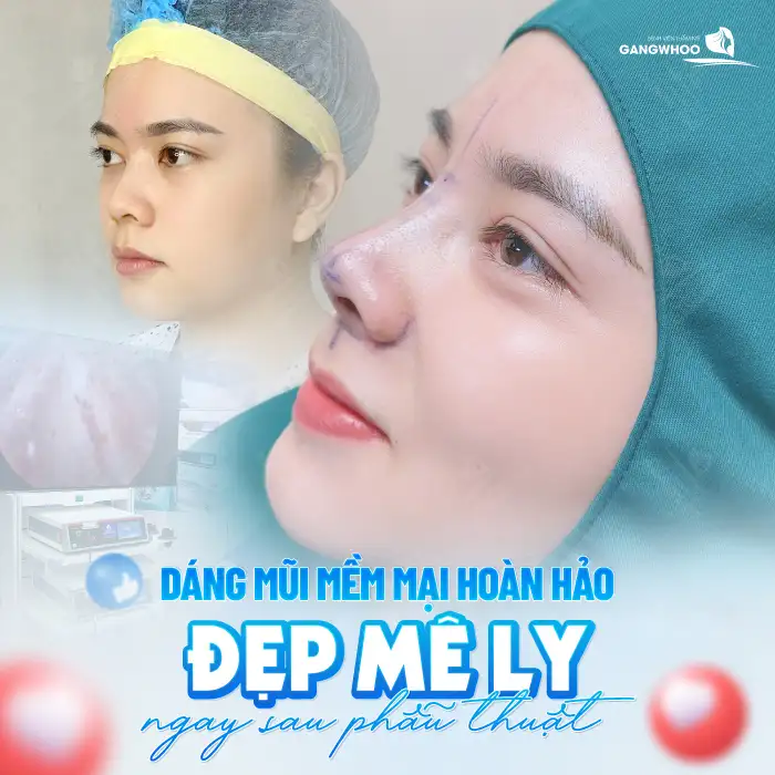 Hậu quả nâng mũi S Line có thễ gặp phải là gì? Cần lưu ý gì?