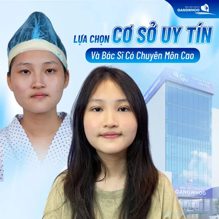 Chia sẽ kinh nghiệm đi cắt mí mắt? Cần lưu ý những gì?