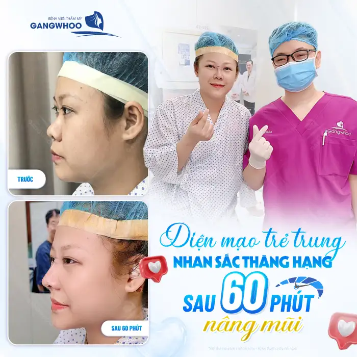 Lớn tuổi có nên nâng mũi không? Có ảnh hưởng đến sức khỏe không?