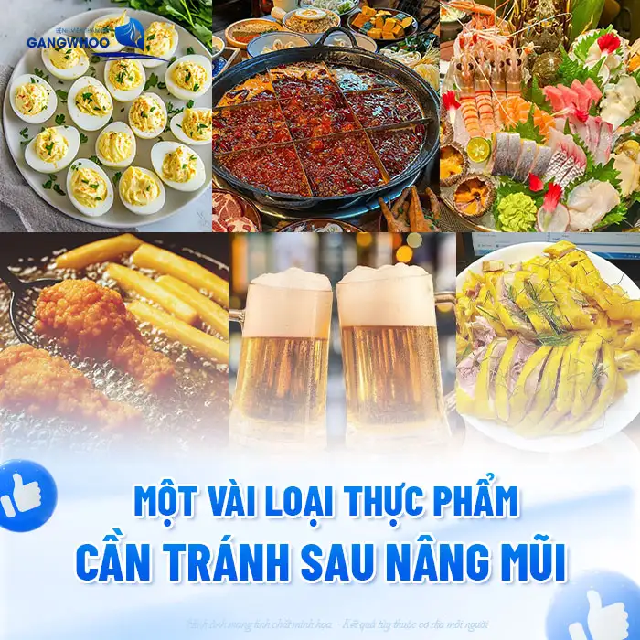 Sau nâng mũi có được ăn bún không? Có ảnh hưởng đến vết thương không?