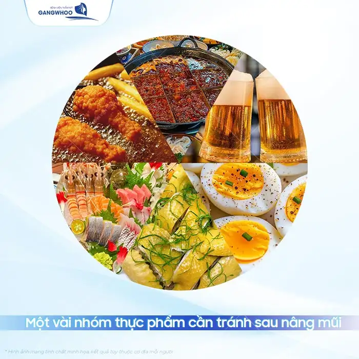 Nâng mũi ăn bún chả cá được không? Có gây ra biến chứng?