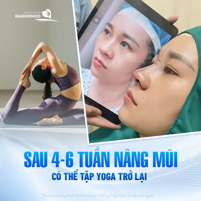 Nâng mũi bao lâu được tập yoga? Những lưu ý khi tập yoga