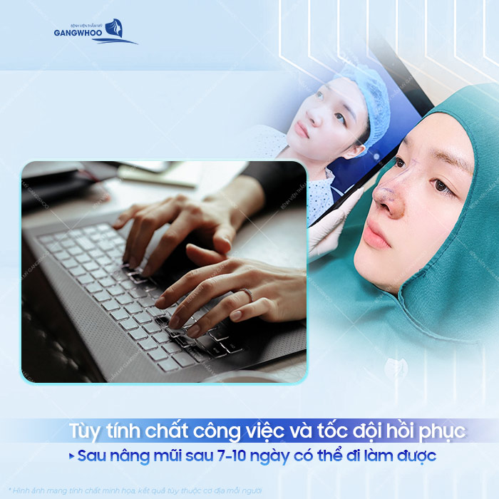 Nâng mũi bao lâu thì đi làm được? Cách chăm sóc mũi nhanh hồi phục?