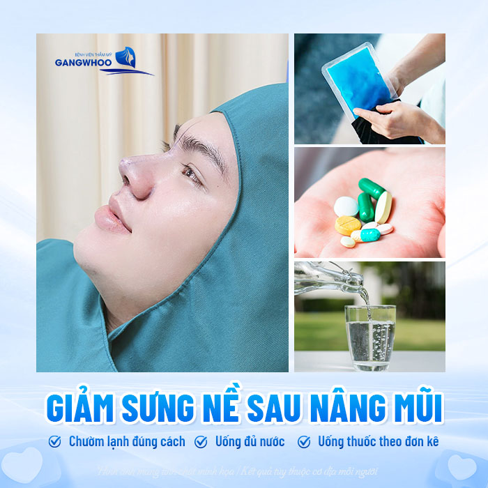 Nâng mũi bị phù nề có bình thường không và làm sao giảm phù hiệu quả?
