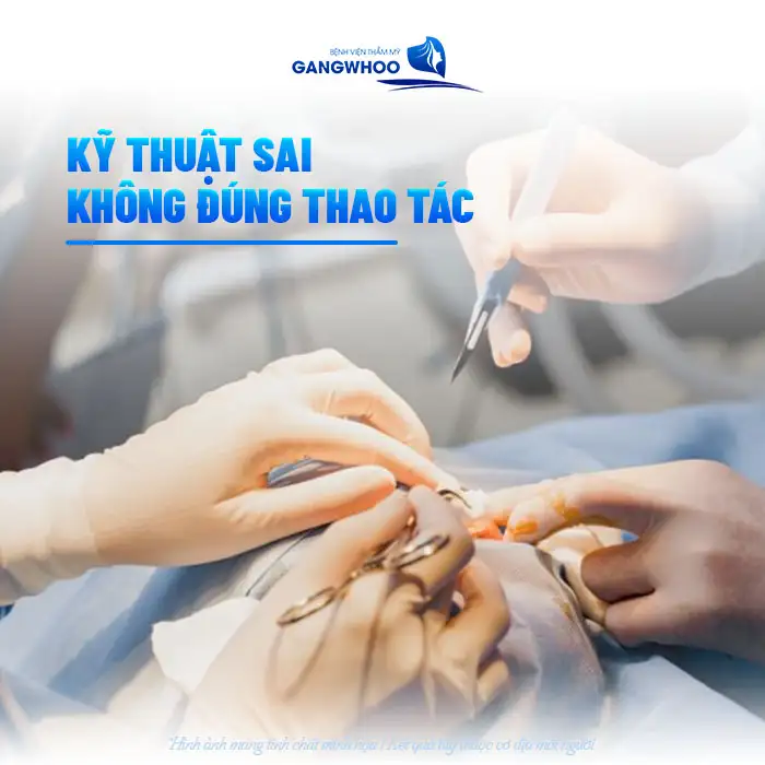 Nguyên nhân nâng mũi bị thủng vách ngăn là gì? Cách xử lý như thế nào?