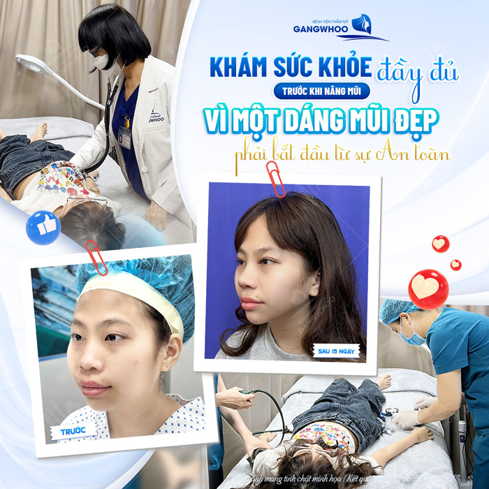 Nâng mũi cấu trúc có sửa lại được không? Chi phí liệu có cao không?