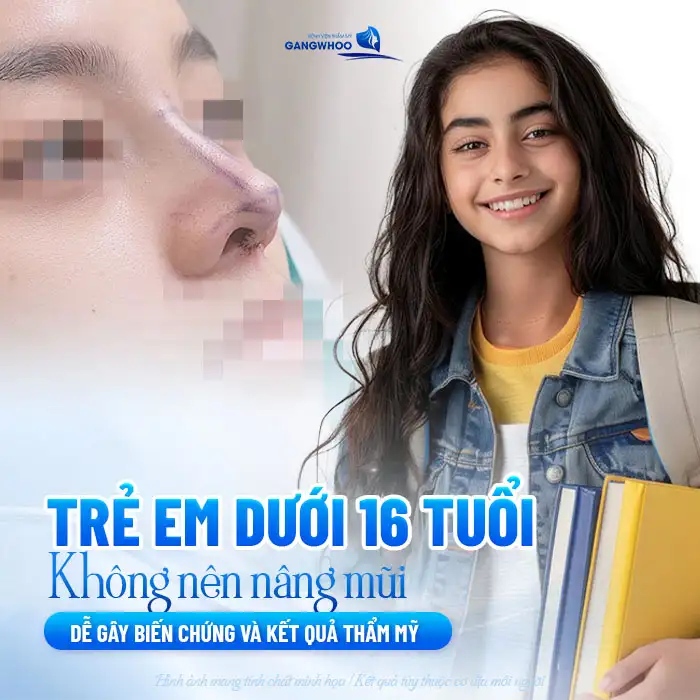 Nâng mũi cho trẻ em nên hay không? Cần lưu ý gì? 2 Nâng mũi cho trẻ em nên hay không? Cần lưu ý gì?