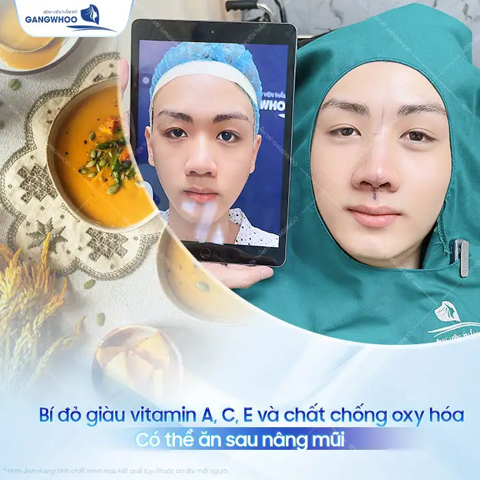 Nâng mũi có được ăn bí đỏ không? Có cần phải kiêng không?