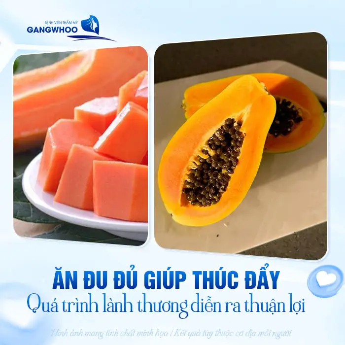 Nâng mũi có được ăn đu đủ không? Nên bổ sung các loại trái cây nào? 2 Nâng mũi có được ăn đu đủ không? Nên bổ sung các loại trái cây nào?