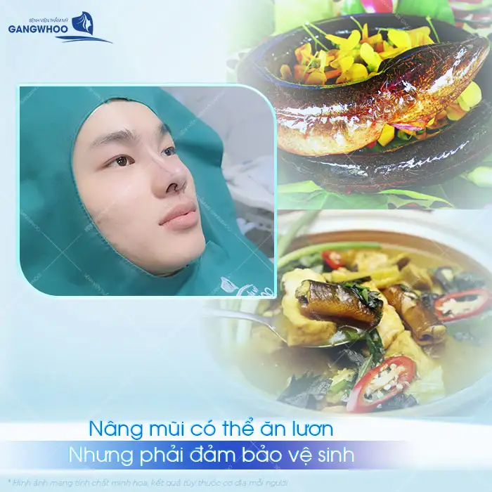 Nâng mũi có ăn được lươn không? Có để lại sẹo hay gây kích ứng?