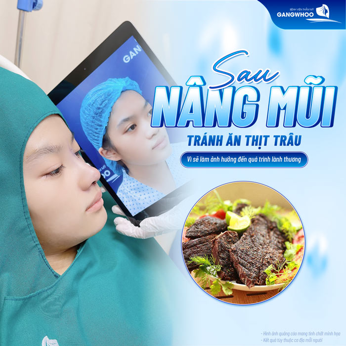 Nâng mũi có ăn được thịt trâu không? Khi nào thì được ăn?