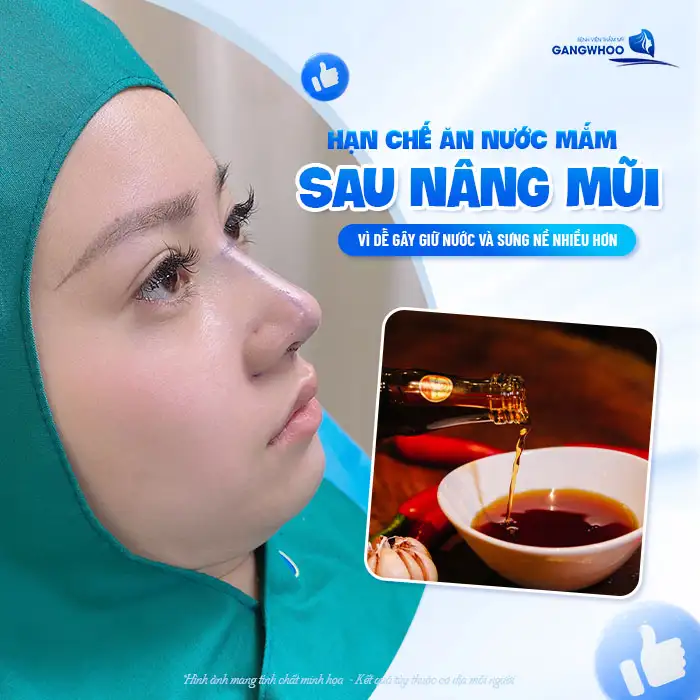 Nâng mũi có được ăn nước mắm không? Có gây ảnh hưởng gì không?