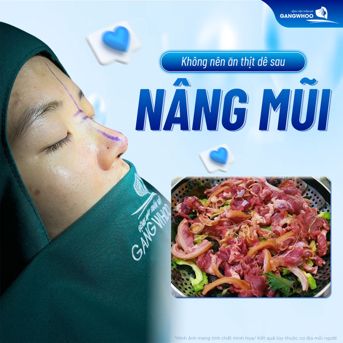 Nâng mũi có ăn thịt dê được không? Có cần lưu ý gì không?